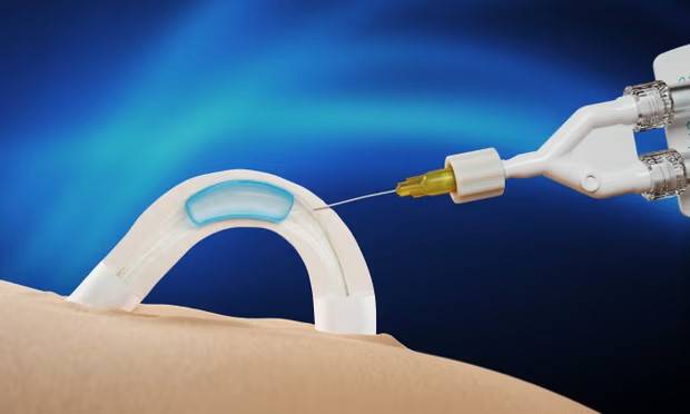 비호르몬 남성 피임법으로 최소 2년간 지속되는 효과가 있다는 임상 1상 결과가 나왔다. [사진= Adam]