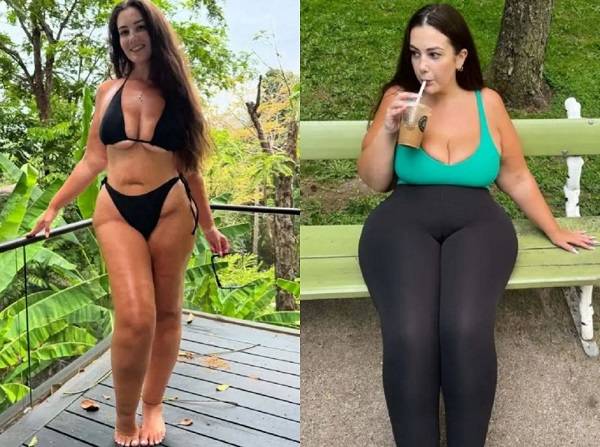 유럽의 한 20대 인플루언서가 지방부종으로 여행 중 겪은 일화를 고백해 화제다./사진=더 선