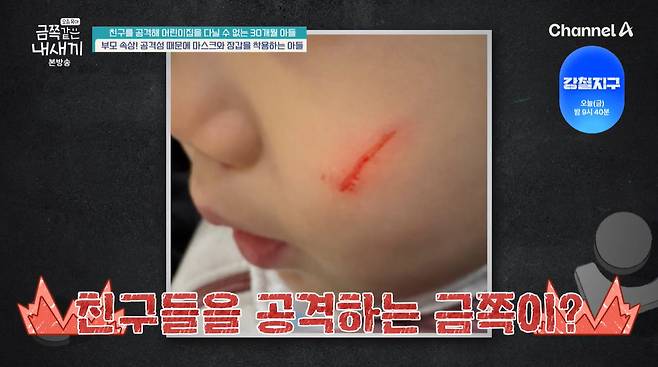친구들을 공격하는 30개월 금쪽이의 사연이 공개됐다./사진=채널A '요즘 육아-금쪽같은 내 새끼' 방송 화면