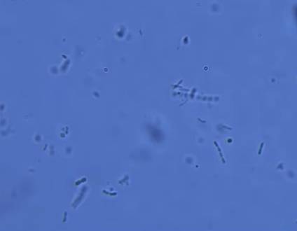 생닭을 씻은 물에서 관찰된 세균들 [유튜브 포켓생물]