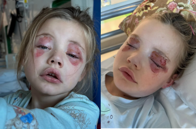 한 여성이 세탁을 하던 중 잠시 한눈을 판 사이, 어린 딸이 잠시 실명을 겪는 사고를 당하면서 다른 부모들에게 주의를 당부하고 나섰다. [사진=SNS]