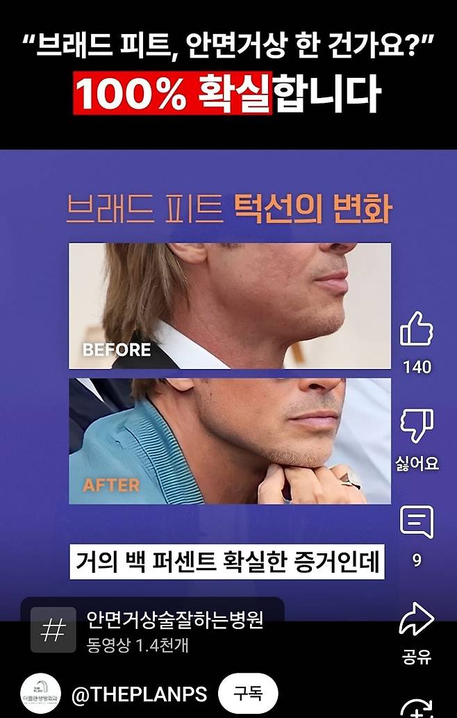 1000039193.jpg 성형외과 의사도 극찬한 1억 6천짜리 성형 받았다는 브래드피트 근황 ㄷㄷㄷ...jpg