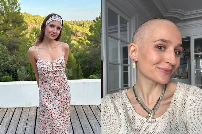 프랑스에 거주하는 20대 여성이 챗GPT가 의사보다 더 빠르게 혈액암을 진단했다고 밝혔다. 사진=마를린 가른라이터/SWNS