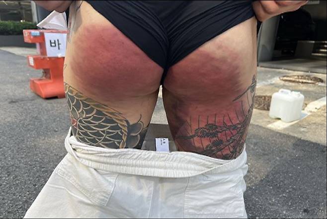 폭행당한 조직원. 인천지검 제공