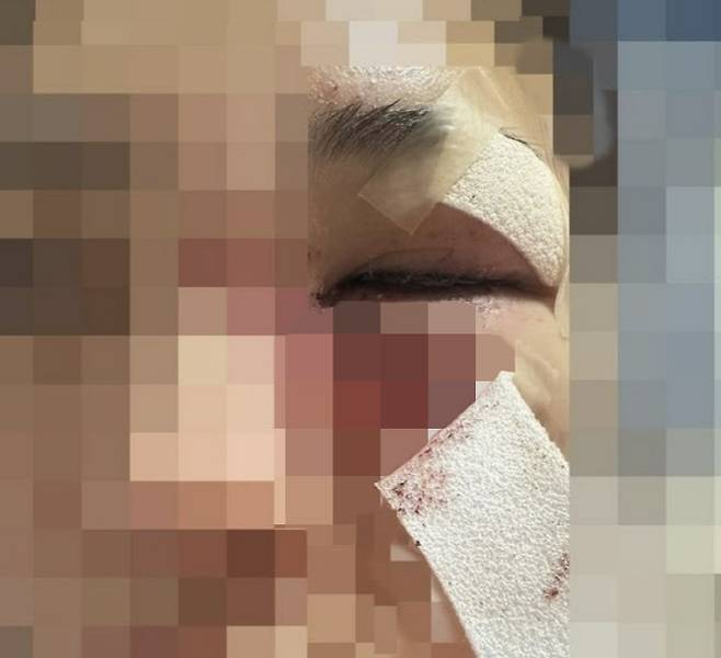 경북 포항시에서 30대 남성이 헤어지자는 여자친구를 폭행해 전치 6주 부상을 입힌 사건이 발생했다. (사진=뉴시스)