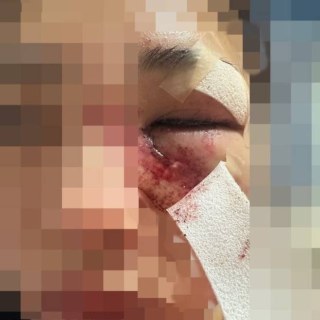 지난 21일 경북 포항에서 이별을 통보한 여자친구를 무차별 폭행한 사건이 발생했다.ⓒ뉴시스