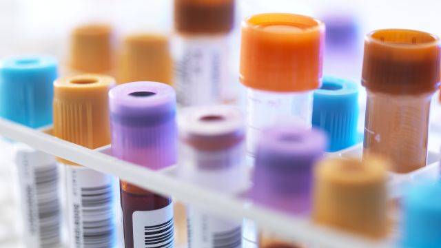 합병증 예방을 위해 혈액 검사, 소변 검사를 받아야 한다|출처: 클립아트코리아