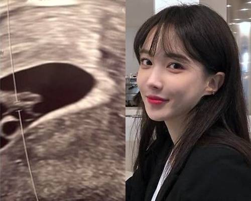 사진 I 서민재 인스타그램