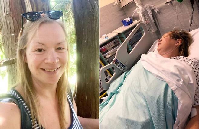 체조 등에서 흔한 카트휠(cartwheel) 동작 후 경동맥이 손상된 40대 영국 여성 사연이 공개됐다. [사진=SNS]