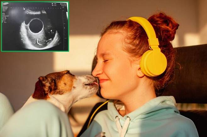 반려견이 얼굴을 핥지 않도록 주의해야 한다는 전문가의 경고가 나왔다. [사진=게티이미지뱅크/왼쪽 상단 사진=Open Journal of Clinical and Medical Case Reports]