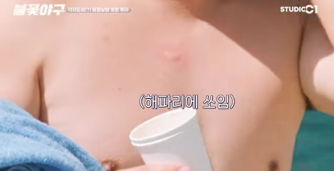 image.png 해파리독 응급 처치