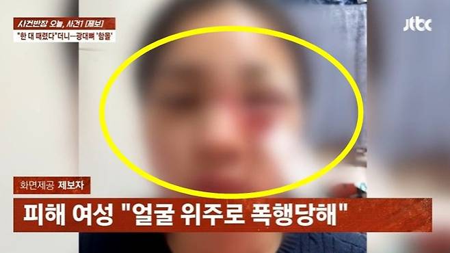 남자친구에게 이별을 통보했다가 길거리에서 마구 폭행당한 뒤 숙박업소에 감금까지 됐다는 20대 여성의 사연이 전해졌다. /사진=JTBC '사건반장' 캡처