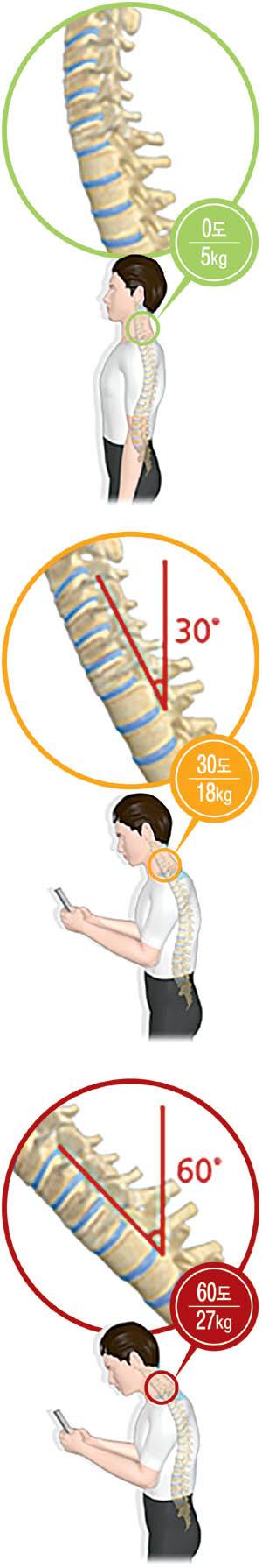 고개 숙이는 각도 따라 경추에 걸리는 무게 변화