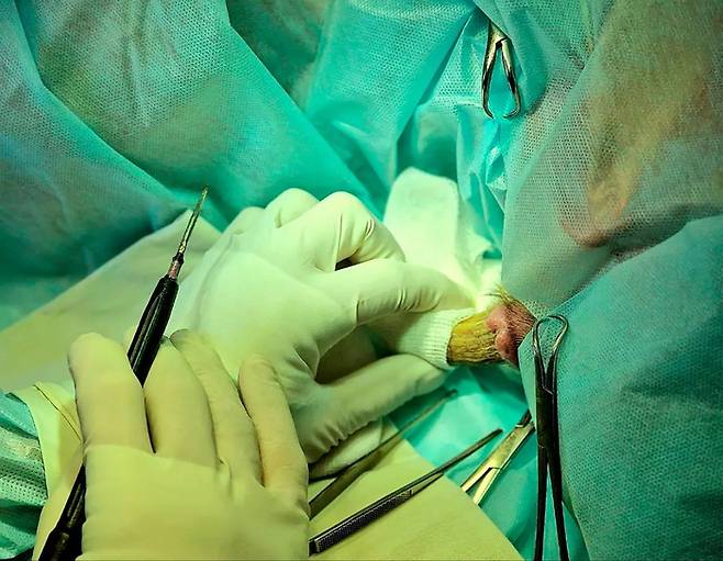 러시아 30세 남성 뒤통수에 자란 뿔(피각). 사진=City Hospital 5 /east2west news