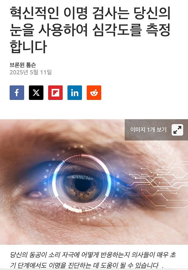 IMG_6074.jpeg 동공 검사로 이명 심각도를 측정하는 기술연구 근황