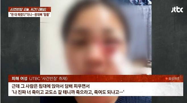 [서울=뉴시스] 폭행으로 인해 광대뼈가 함몰된 여성의 모습. (사진= '사건반장' 유튜브 캡처) 2025.05.09. *재판매 및 DB 금지