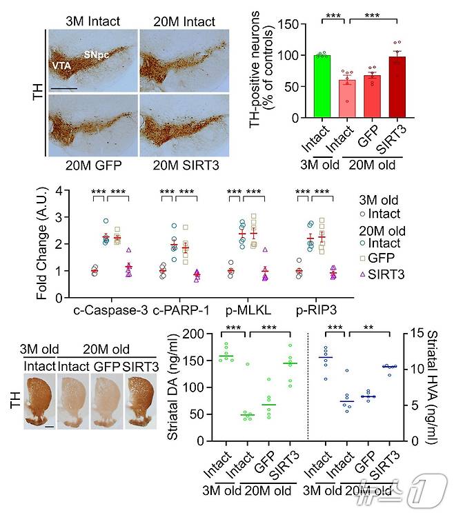 흑질-선조체 도파민 신경계 기능 연구(한국연구재단 제공) /뉴스1