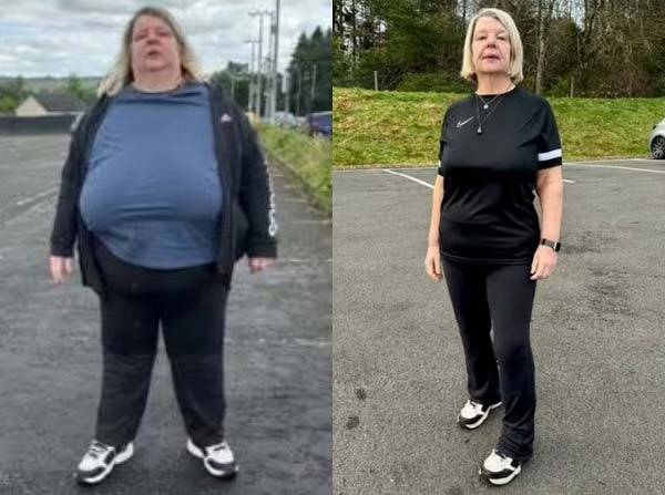 스코틀랜드의 한 여성이 주사나 약 없이 18개월간 82kg 감량에 성공한 비법을 공개했다./사진=데일리 익스프레스