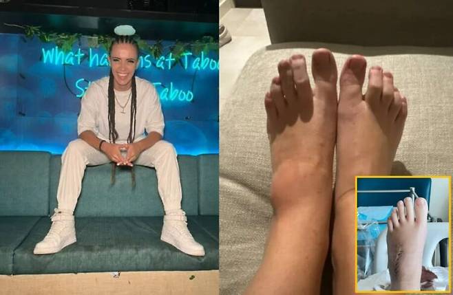 발에 박힌 나무 파편 때문에 5년 동안 기억력 저하, 발작, 극심한 피로에 시달린 여성의 사연이 소개됐다. [사진=SNS]