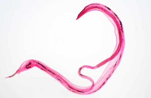 주혈흡충증을 유발하는 기생충 [사진 출처 = 데일리메일]