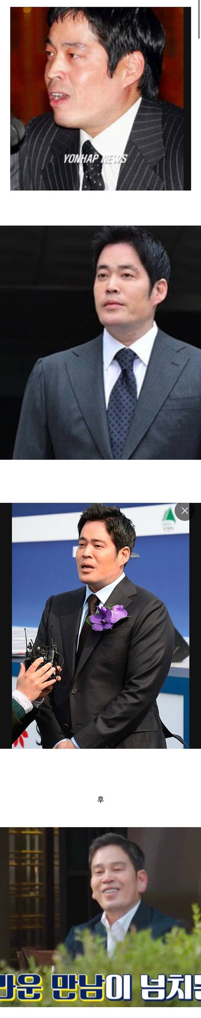 정용진 회장의 귀 모양 변천사