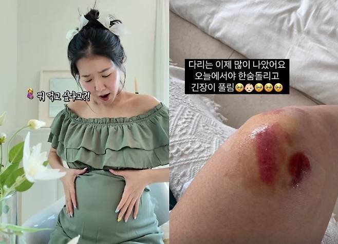 사진=김지혜 소셜미디어