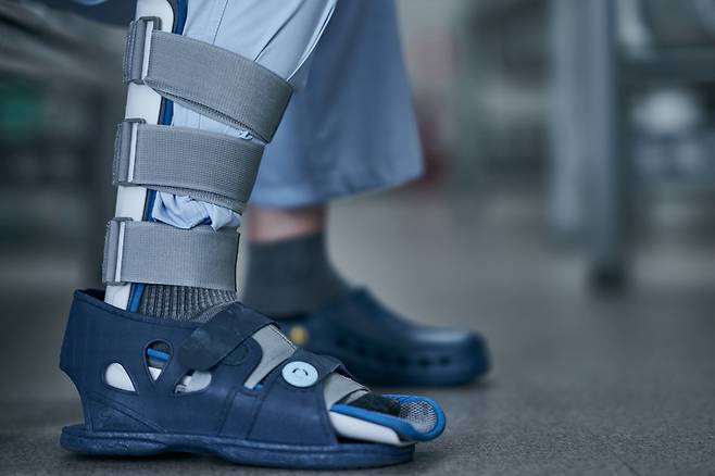 정형외과에서 다리에 깁스를 하고 있는 환자. 지난해 의료사고를 둘러싼 의료분쟁 조정의 성공 건수는  정형외과(약 21%)가 가장 많았고, 내과(약 14%), 치과(약 125%)가 그 뒤를 이었다. [사진=게티이미지뱅크]