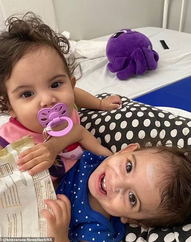 [서울=뉴시스] 브라질 샴쌍둥이 자매가 60명에 가까운 의료진이 동원된 15시간 대규모 수술 끝에 성공적으로 분리됐다. 샴쌍둥이 자매의 모습. (사진 = 데일리메일 캡처) 2025.05.15. *재판매 및 DB 금지