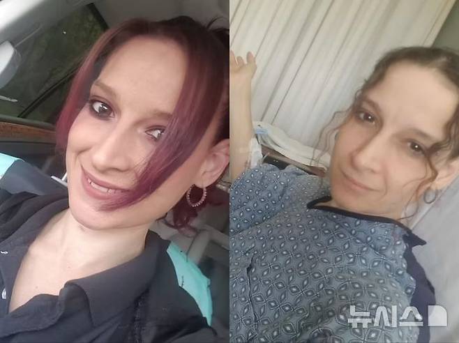 [서울=뉴시스] 20년 동안 이어 온 흡연을 끊고 전자담배로 바꾼 미국의 한 여성이 폐포가 부풀어 생명을 위협받는 상황을 겪은 뒤 자신의 사례를 공유했다. (사진=데일리메일)