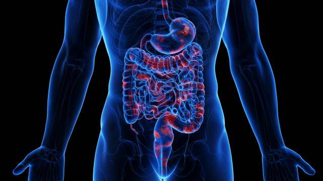 염증성 장질환은 장에 만성적 염증이 발생하는 질환이다｜출처: 클립아트코리아