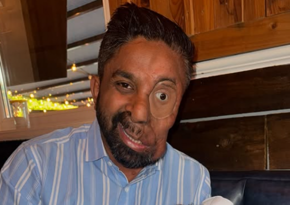 영국에서 신경섬유종증을 앓고 있는 30대 남성이 어린 시절부터 끊임없는 괴롭힘을 당해왔지만 온라인상에 자신의 이야기를 공유하면서부터 많은 사람들에게 희망이 되고 있다는 사연이 전해졌다. 인스타그램 캡처