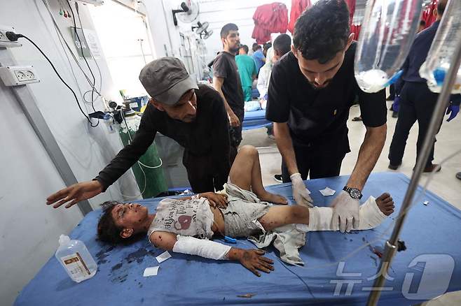 19일(현지시간) 이스라엘 공습으로 부상당한 팔레스타인 소녀가 가자 지구 중부 누세이라트 난민 수용소의 알 아와다 병원에서 치료를 받고 있다. ⓒ AFP=뉴스1