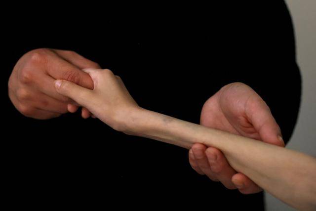 영양실조에 걸린 가자지구 출신 어린이 라하프 아야드가 19일 아랍에미리트 아부다비의 한 의료시설에서 치료를 받고 있다. 아부다비=로이터 연합뉴스