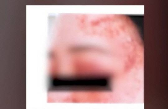 럭비 국가대표 출신 방송인 A씨로부터 폭행당한 B씨의 모습. [MBC 보도화면 갈무리]