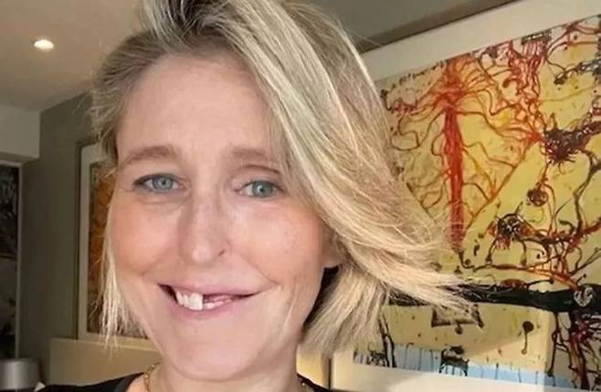 [뉴시스] 호주의 사라 수삭(48)은 남편과 입맞춤 후 찌릿함을 느낀 이후 찾은 병원에서 두경부암 판정을 받았다(사진=야후 뉴스 캡쳐) 2025.05.20 *재판매 및 DB 금지