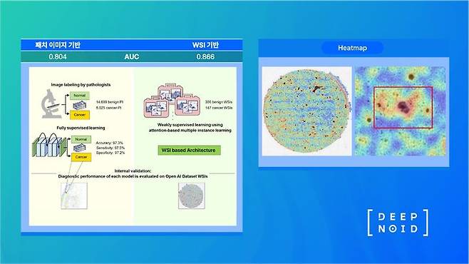 [서울=뉴시스] 22일 딥노이드는 가톨릭의대 의정부성모병원와의 공동 연구 논문이 국제 학술지에 게재되며 인공지능(AI) 진단의 우수성이 입증됐다고 밝혔다. (사진=딥노이드 제공) 2025.05.22. photo@newsis.com *재판매 및 DB 금지
