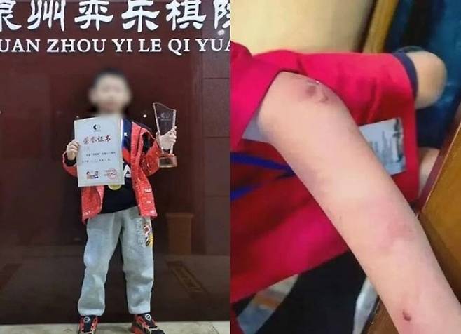 중국의 9세 바둑 신동이 사망한 가운데 경기에서 질 때마다 아버지의 폭력이 있었다는 사실이 밝혀졌다. (사진=소후닷컴)