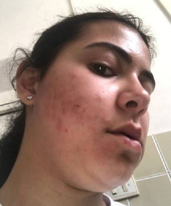 미국의 한 20대 여성이 동료의 실수로 쇼크 증상이 발생해 응급실에 실려 간 사연이 공개됐다./사진=더 선