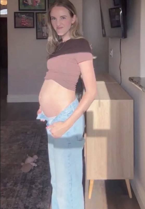 [서울=뉴시스] 후퇴성 인두기능장애 때문에 가스가 차서 복부가 팽만한 칼리샤 레이.(사진=더선 보도 갈무리) *재판매 및 DB 금지