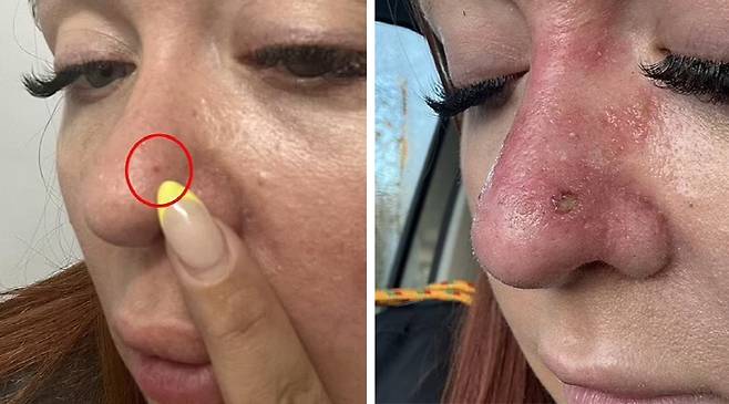 사진출처=데일리메일, 잼프레스