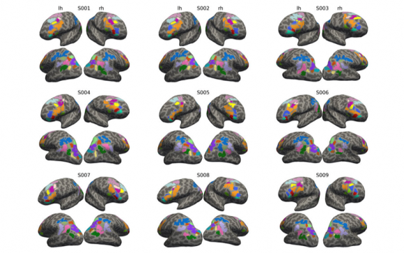 캘리포니아대학 버클리 캠퍼스 연구팀은 기능자기공명영상법으로 6~18세 건강한 지원자들이 사고력을 검증하는 과제를 수행할 때 뇌 활동을 촬영했다. 출처=UC Berkeley