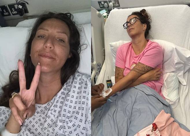 운동으로 인한 단순한 근육통인 줄 알았던 사타구니 통증이 낭종이 터져 생긴 증상으로 죽을 뻔 한 여성의 사연이 전해졌다. [사진=SNS]