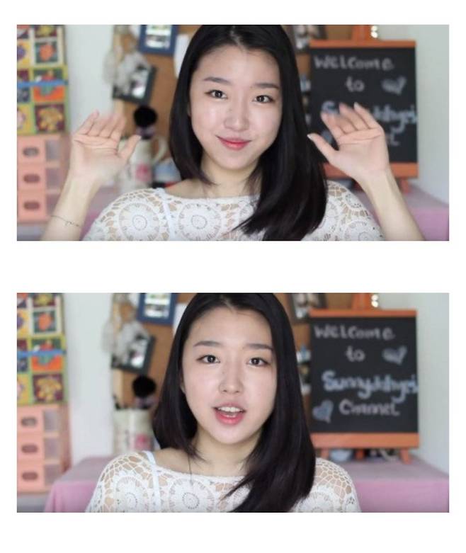 어느 여성 유투버의 성형 전후 모습