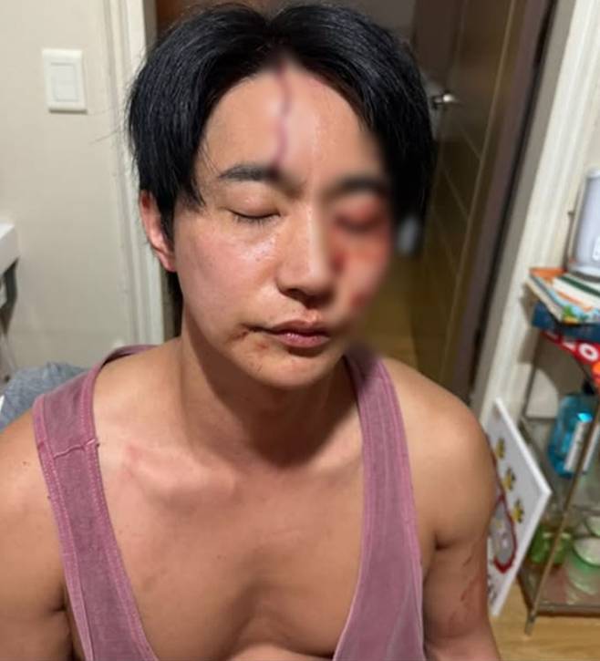 전호준은 지난 25일 자신의 인스타그램을 통해 머리에 피 흘리는 사진과 지난 24일 새벽 당시 상황을 담은 음성을 공개하며 "왜곡된 주장과 허위 사실"이라고 전 여자친구 A씨 폭로에 대해 반박했다./사진=전호준 인스타그램