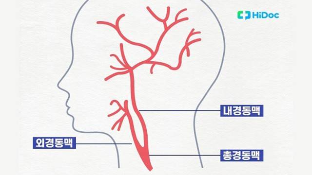 경동맥｜출처: 하이닥