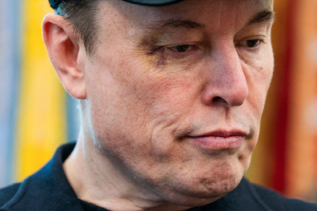 지난달 30일(현지 시간) 백악관에서 열린 약식 기자회견에 눈가에 멍이 든 상태로 등장한 일론 머스크 테슬라 최고경영자(CEO). AFP 연합뉴스