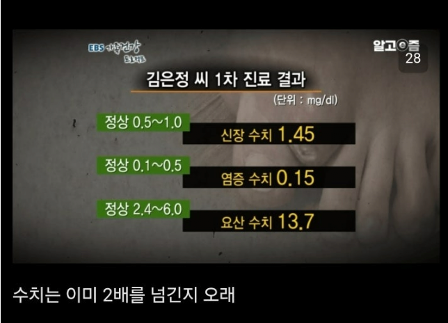 통풍 방치하면 안되는이유