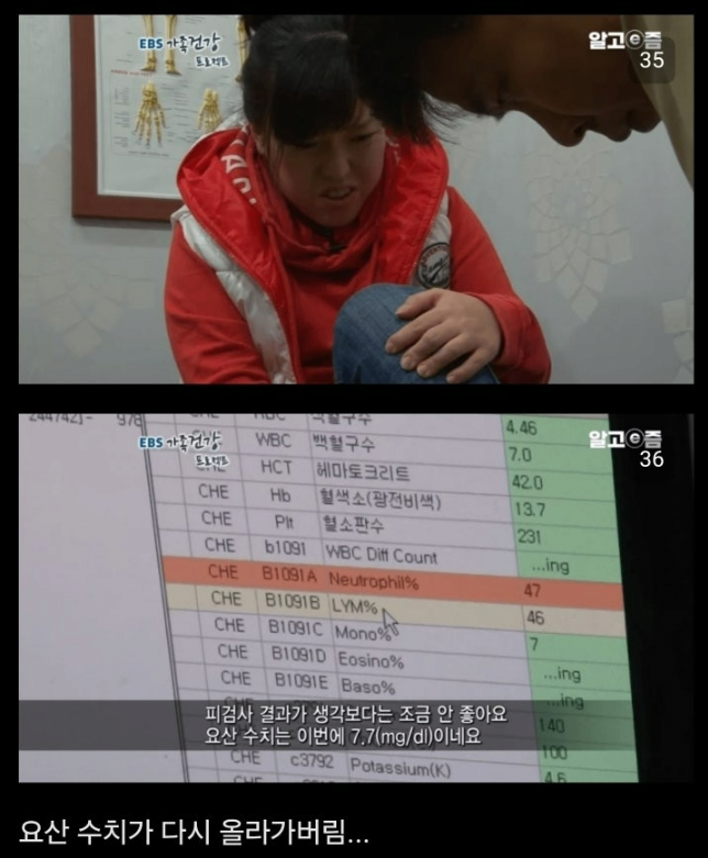 통풍 방치하면 안되는이유