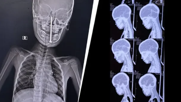 ⓒ인디아투데이