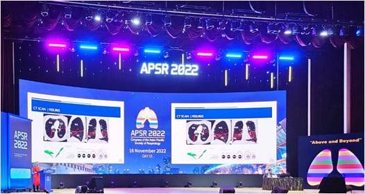 지난 2022년 11월 제26차 아시아태평양호흡기학회(APSR)가 서울 강남구 코엑스에서 열렸다./대한결핵 및 호흡기학회